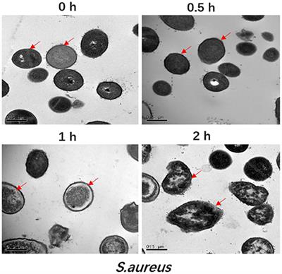 Effects of Antibacterial Peptide F1 on Bacterial Liposome Membrane Integrity